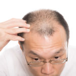 抜け毛予防に効く「ツボ」