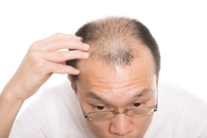 抜け毛予防に効く「ツボ」